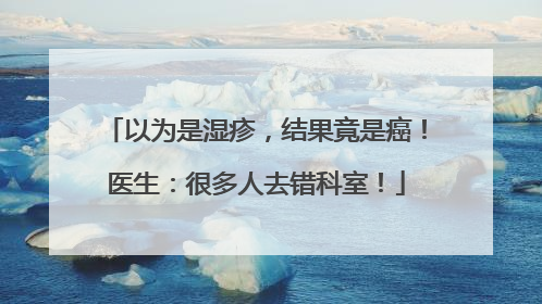 以为是湿疹，结果竟是癌！医生：很多人去错科室！